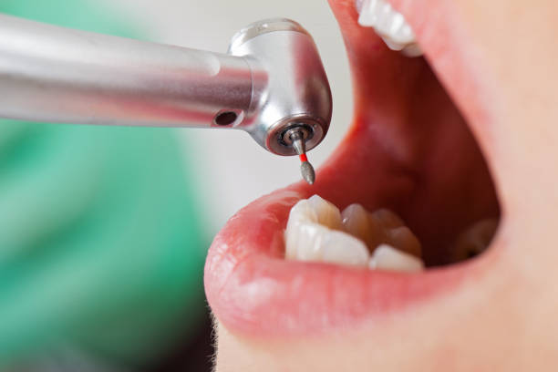 Best Weekend Emergency Dentist in Wentzville, MO